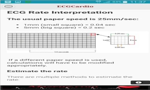 ECGCardio