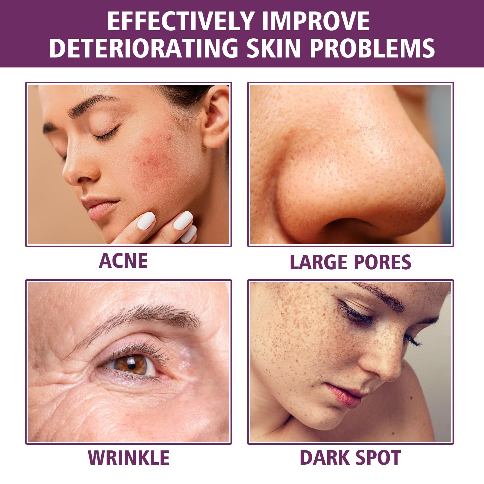 Niacynamid 20% serum do twarzy, rozjaśniające, poprawia elastyczność, nawilża, przeciwzmarszczkowe, wygładza cerę, wygładza drobne linie, zmniejsza pigmentację (12 szt.)