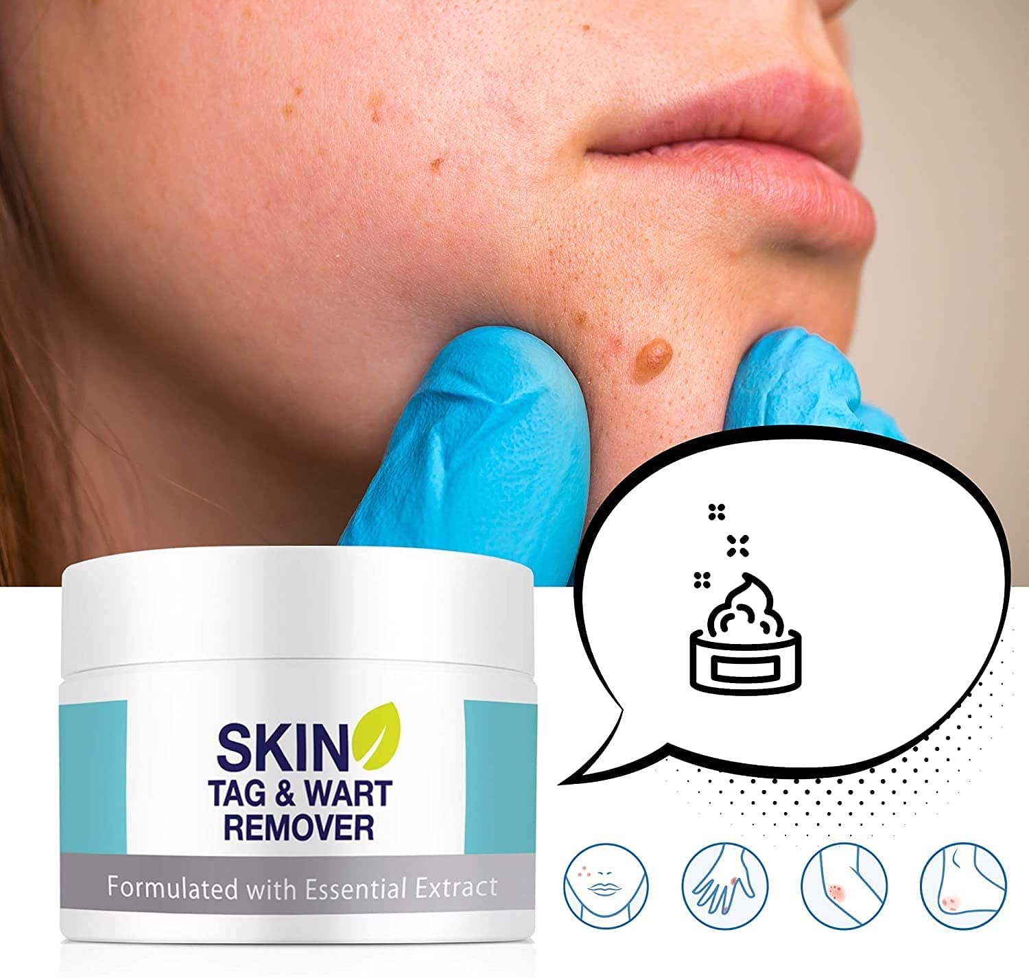 Skin Tag Remover, Warts & Mole Remover Cream, Skin Tags Dry and Fall