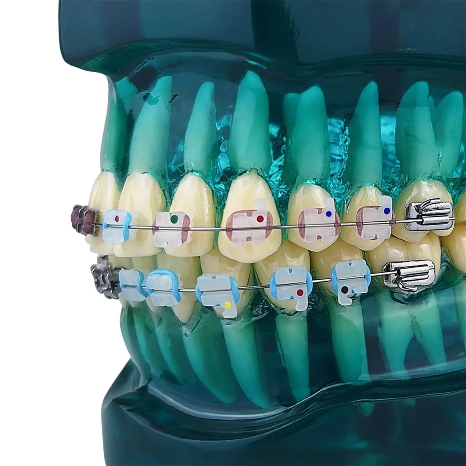 Modello ortodontico per la comunicazione del paziente, trattamento odontoiatrico demo con staffe metalliche autoliganti, ideale per cliniche e scopi educativi