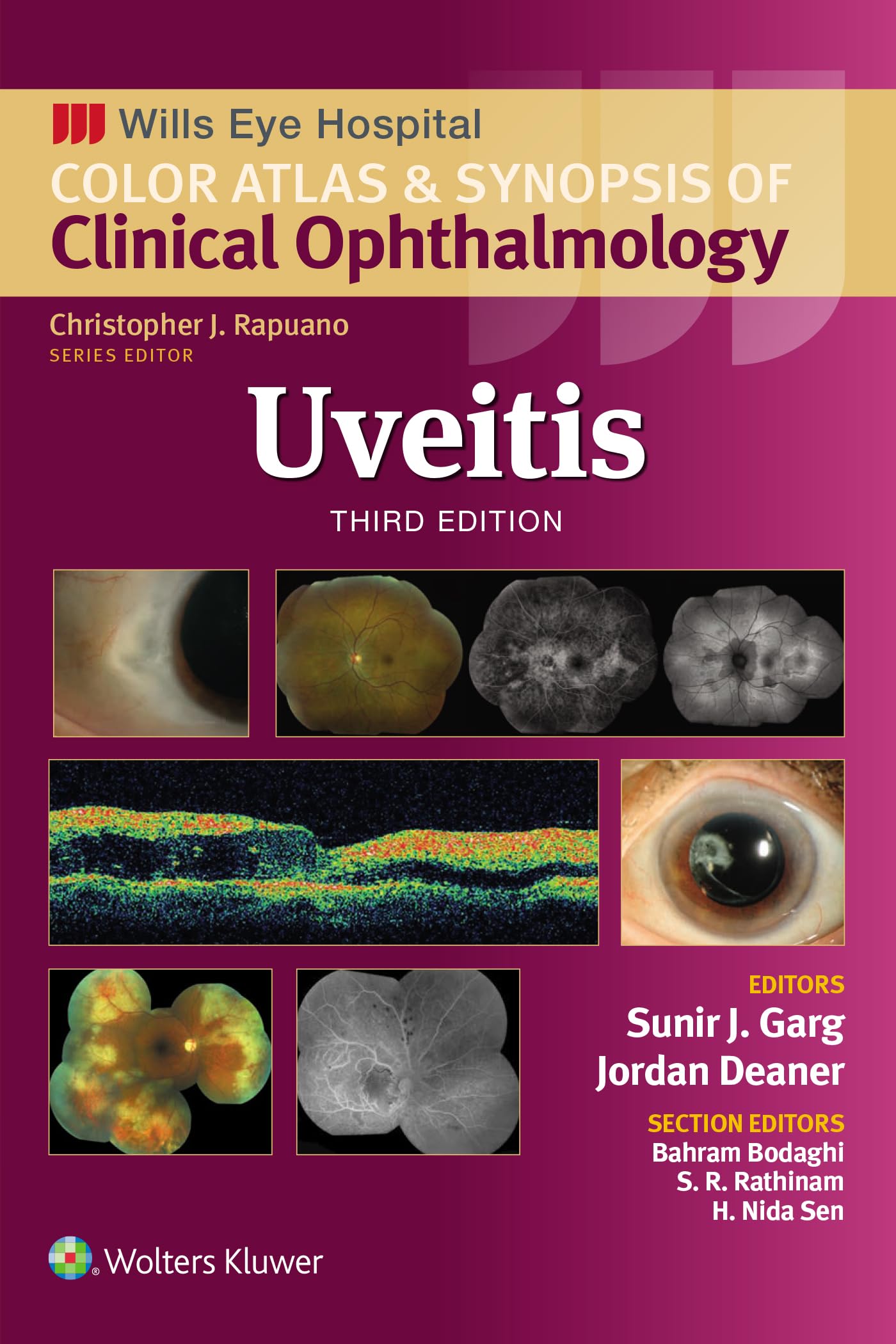 Uveitis (Wills Eye Institute Atlas Series) (English Edition)