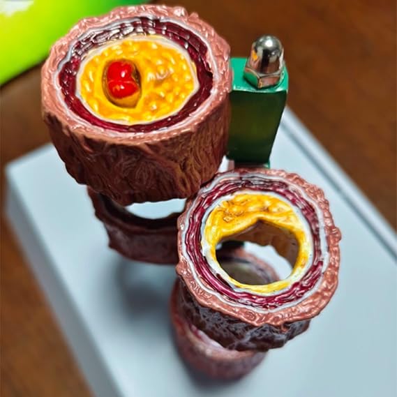 4-Piece Artery Model with Detachable Base, Realistic Human Artery Blood Vessel Anatomy Model, Arteriosclerosis Teaching Tool for Anatomy and Physiology Education