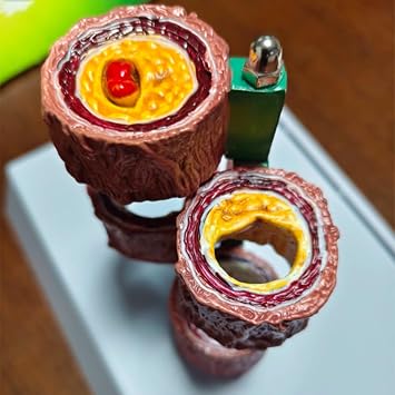 4-Piece Artery Model with Detachable Base, Realistic Human Artery Blood Vessel Anatomy Model, Arteriosclerosis Teaching Tool for Anatomy and Physiology Education