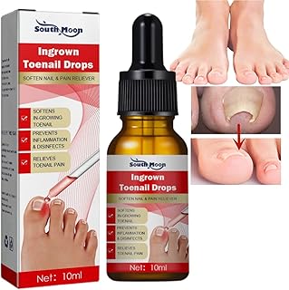 Ingrown Toenail Treatment,Nail Helper,Nail Growth Treatment,Ingrowing Toenail Treatment,Ingrown Toenail Correction Drops,Ingrown Toenail Corrector,Treatment for Ingrown Toenail,Cuticle Oil