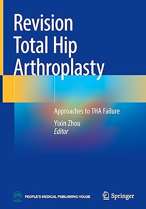 Revision Total Hip Arthroplasty: Approaches to THA Failure