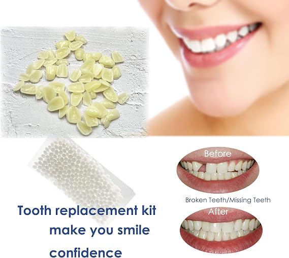 1 Pack Dental Temporary Veneer Tooth Thin Veneers with Filling Beads for Teeth Upper and Lower Anterior Whitening or DIY, A2