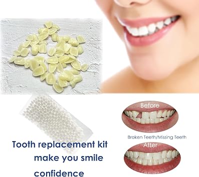 1 Pack Dental Temporary Veneer Tooth Thin Veneers with Filling Beads for Teeth Upper and Lower Anterior Whitening or DIY, A2