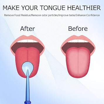 Cordro Tongue Scraper Attachment Replacement Compatible with Waterpik Water Flosser, Tongue Cleaner Tip Replacement for Waterpik Flosser, Oral irrigator Tongue Cleaner Tips, 3 PCS