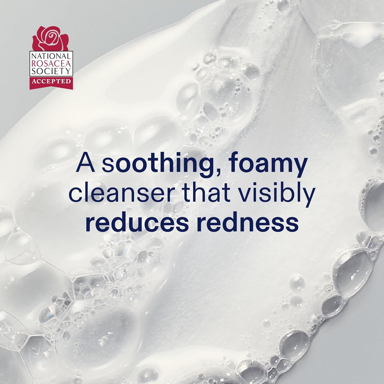 Skinfix Foaming Oil Cleanser for Face - 6 oz - Rich Gel-to-Foam Formula to Hydrate & Soothe Dry, Sensitive Skin - Fragrance Free, Vegan, Cruelty Free - Image 2