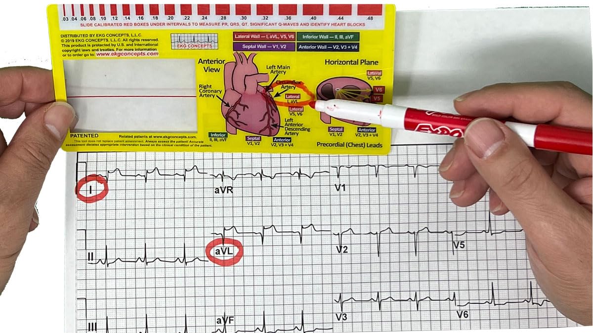 R-Cat EKG-Karte (EKG) Fenster EKG-Tool für Sanitäter, Krankenschwestern und Ärzte