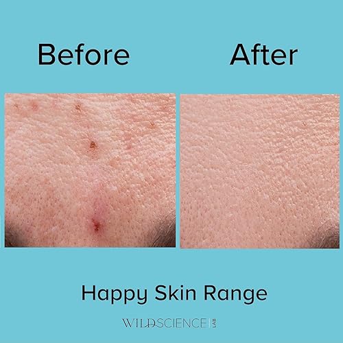 Miniatura 6 de Wild Scicen Lab HAPPY BALANCE AHA + BHA + esencia aclarante de zinc para pieles propensas al acné