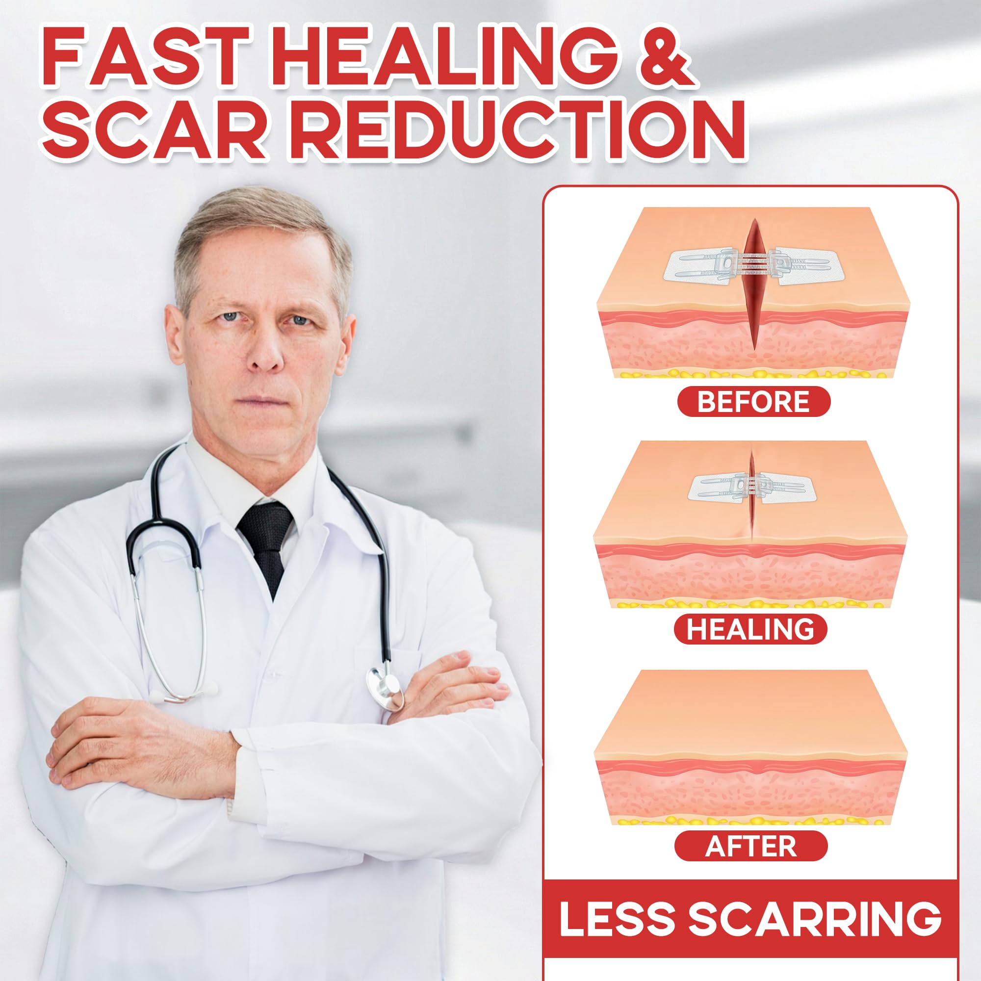 3 PCS Wound Closure Strips, Adjustable Needle-Free Skin Closure Strips — Amazon image 5