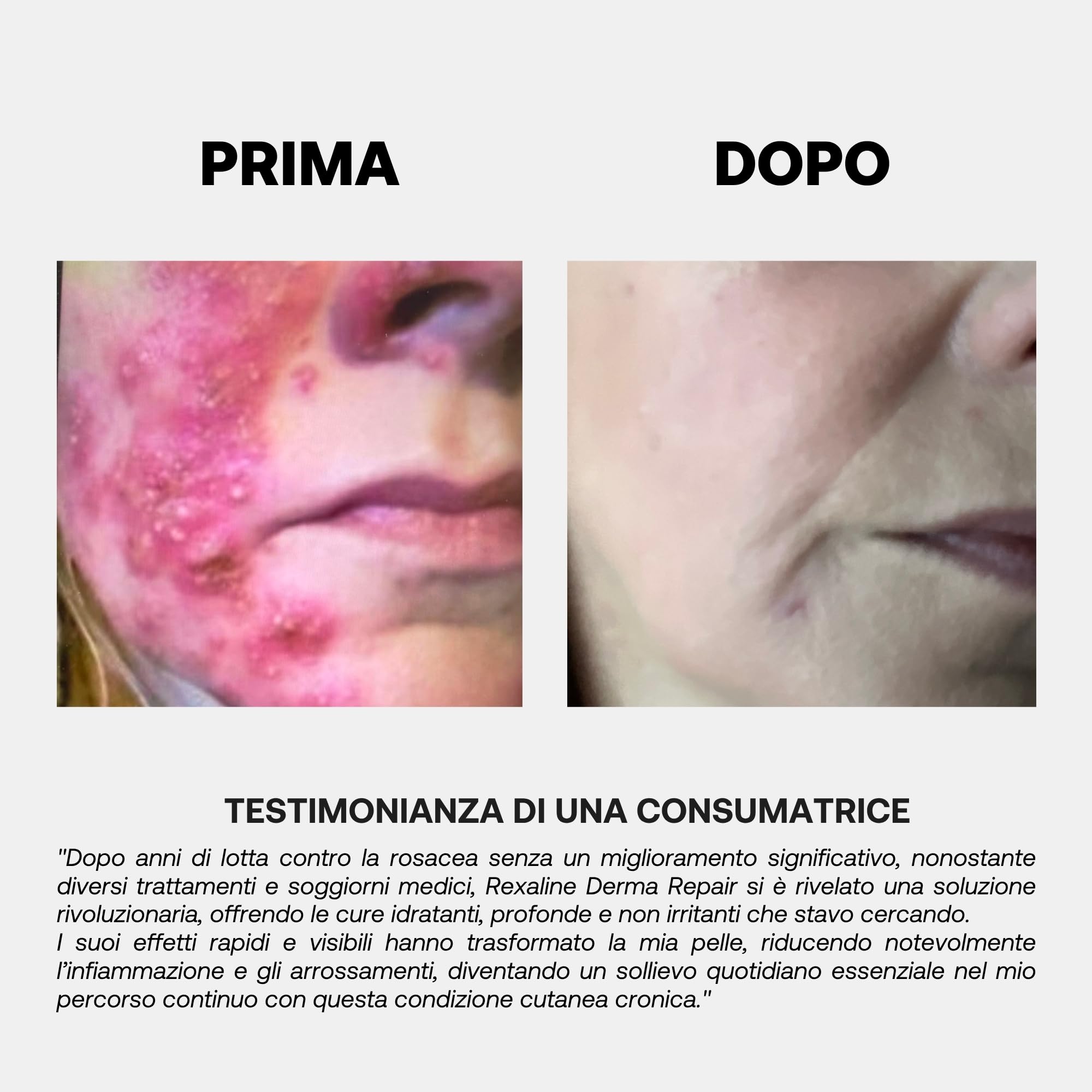 Rexaline Derma Repair Crema – Trattamento Riparatore per Pelli Sensibili, Secche o Irritate – Idratazione Profonda & Azione Lenitiva – Acido Ialuronico RX2 – Senza Silicone – 50 ml