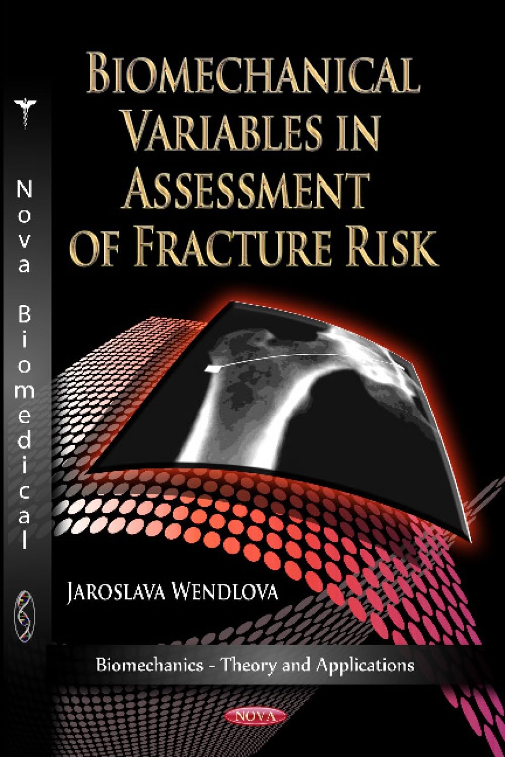 Buy Biomechanical Variables in Assessment of Fracture Risk (Biomechanics-theory and Applications) — BookShops.in
