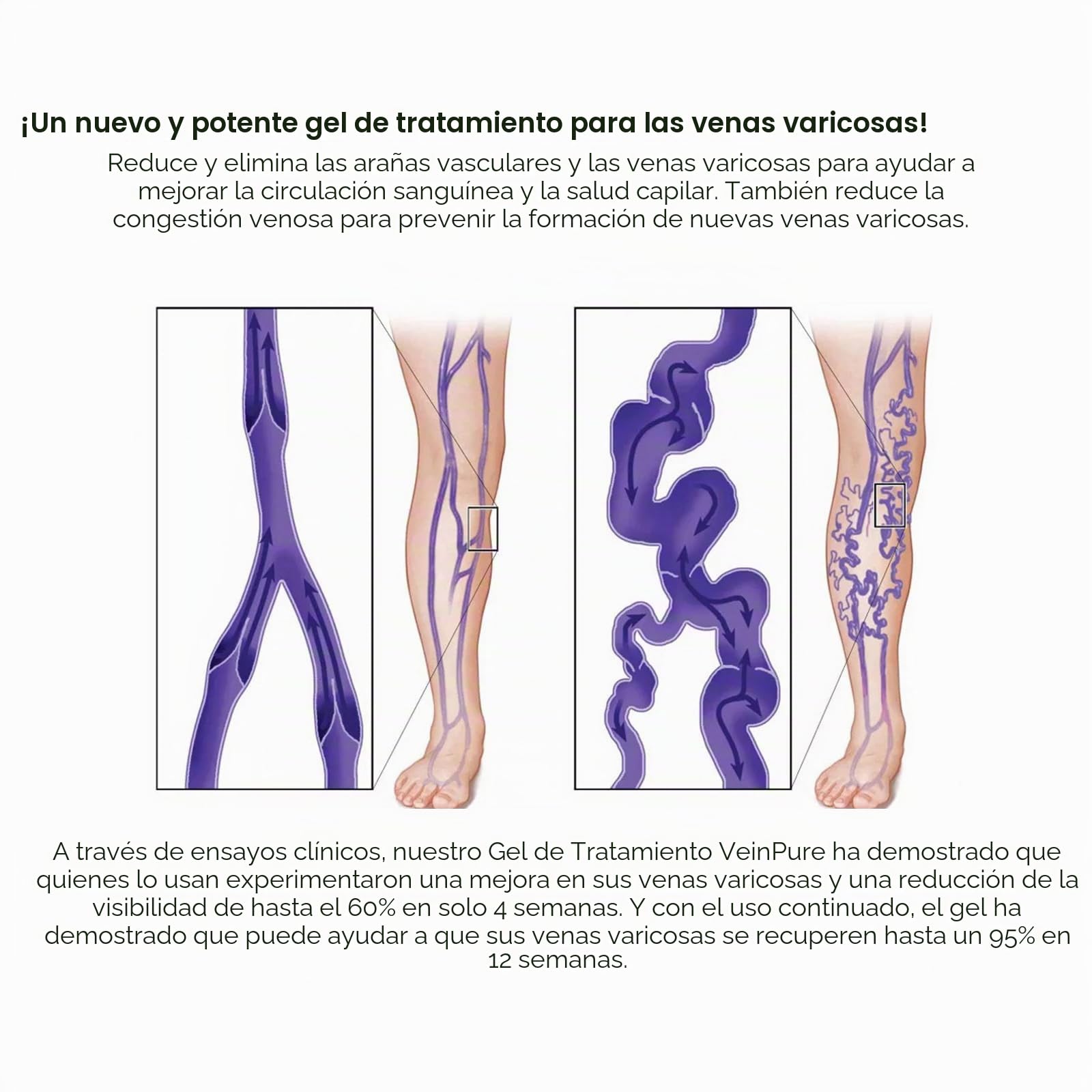Crema Reparadora de Patas de Araña, Varicoso Vena Calmante Pierna Crema, Crema para Venas de araña para Uso Externo, Eliminación de Arañas para el Dolor de Piernas y Muslos