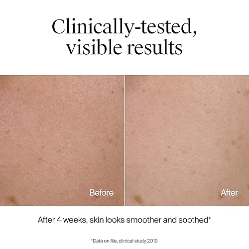 Miniatura 6 de Neutrogena Hydro Boost - Limpiador facial calmante de leche, limpiador facial hidratante sin fragancia con ácido hialurónico, lavado facial de piel