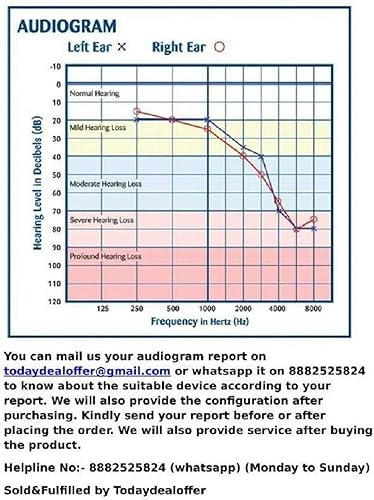 Miniatura 2 de Signia Sleeve Click CIC ITC & RIC - Cúpulas para audífonos (6 unidades, color negro, en la oreja, para audífonos Siemens Click)