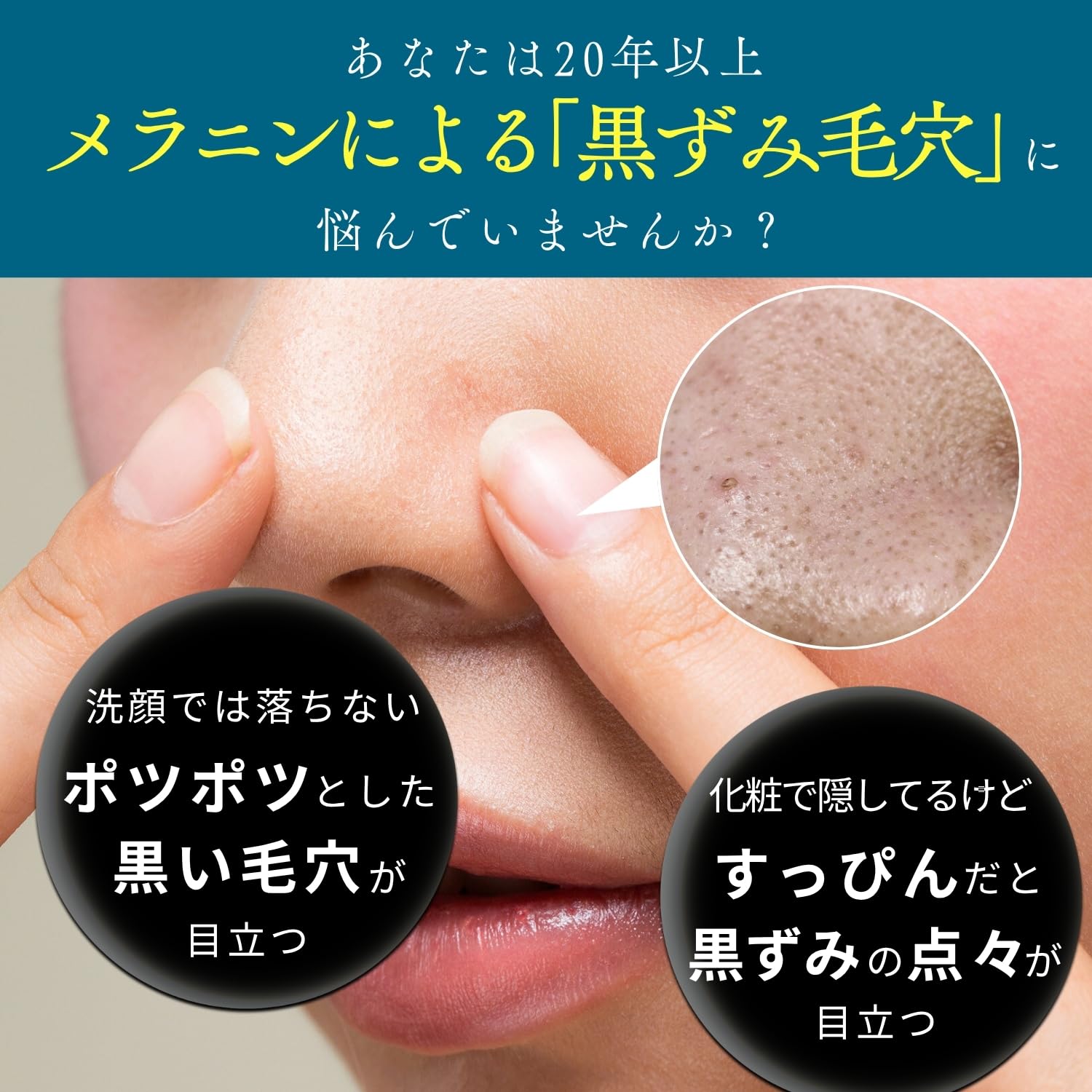 Amazon | 【鼻のメラニン黒ずみ毛穴対策 】 ソワン ポアリペア