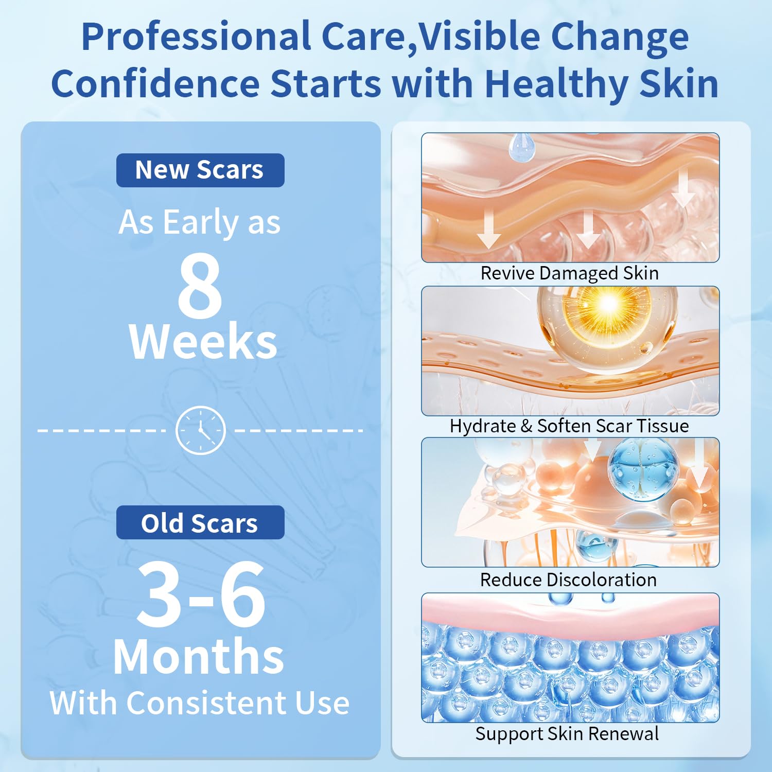 Silicone Scar Gel for Old & New Scars, Advanced Scar Removal Cream, Medical Grade Silicone Scar Cream Treatment for Surgical, C-Section, Burns, Keloids & Acne (1.05 oz) 30g — Amazon image 3