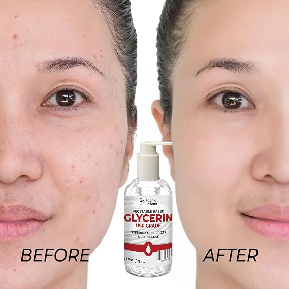 32 fl oz Vegetable-Based Glycerin | USP Grade | Softens & Moisturizes | Multi-Purpose (16 fl oz x 2)