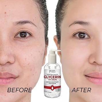 32 fl oz Vegetable-Based Glycerin | USP Grade | Softens & Moisturizes | Multi-Purpose (16 fl oz x 2)