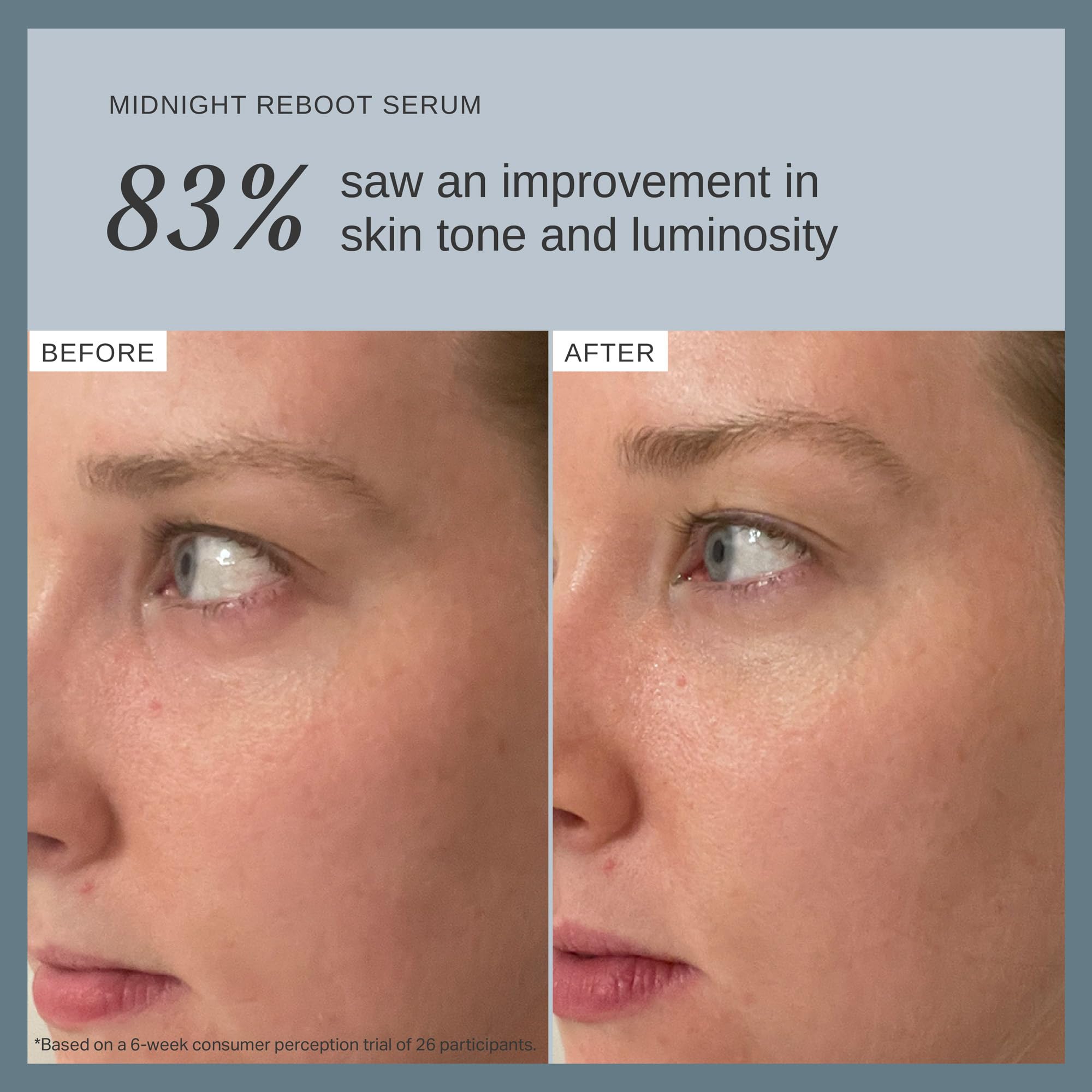 Alpha-H Midnight Reboot Night Serum With Glycolic Acid And Retinoid - Overnight Skin Smoothing For Uneven Tone, Texture, And Fine Lines - Wake Up To Brighter, Fresher-Looking Skin