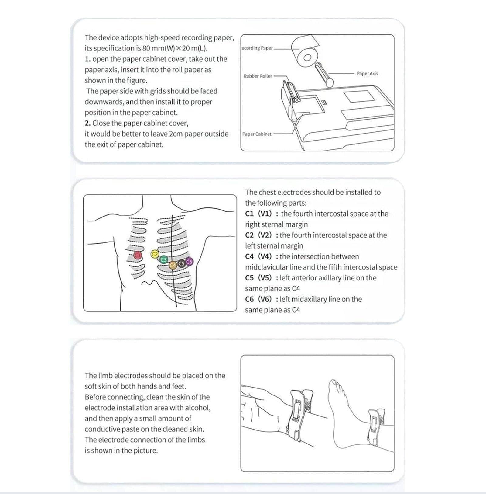 Moniteur Ecg Patient, Surveillance Cardiaque à Domicile, 6 Canaux 12 Dérivations, Avec Mode De Démonstration Des Tracés Ecg, Multilingues, Capacité De Stockage De Plus De 1 000 Enregistrements.