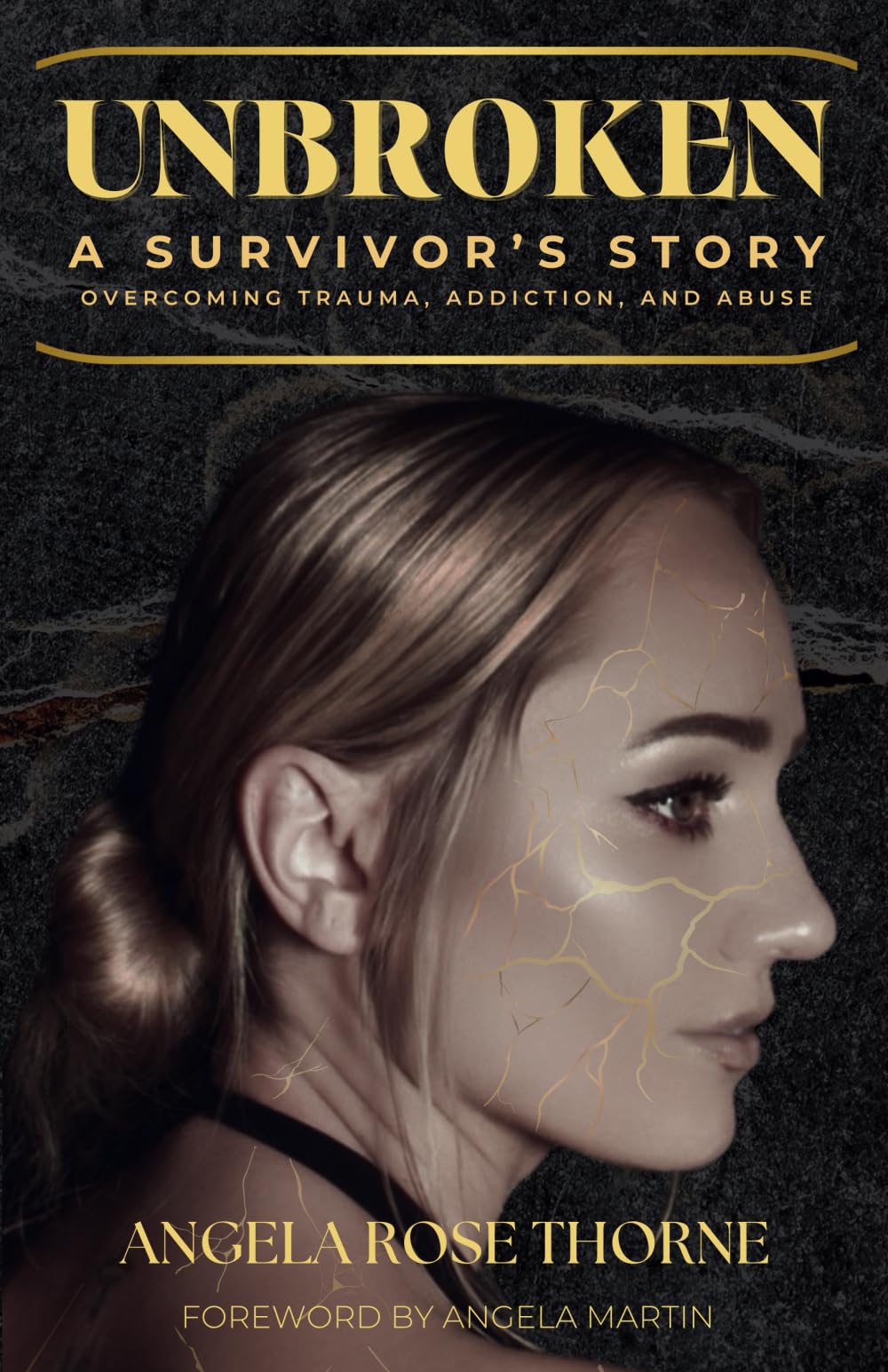 Unbroken: A Survivor's Story: Overcoming Trauma, Addiction and Abuse