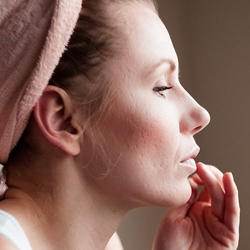 Miniatura 2 de Ecological Formulas Strata Melazepam - Crema emoliente para espinillas, puntos negros, brotes, enrojecimiento y otras condiciones antiestéticas.