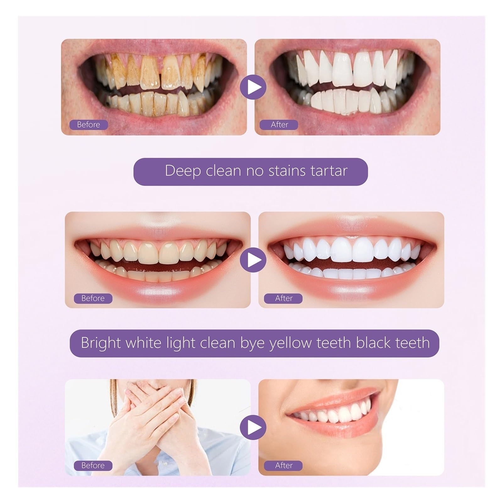 Polvo de limpieza dental for cuidado bucal 80 g | Elimina manchas de café y té, limpia la suciedad superficial de los dientes y refresca el aliento.(3pcs)