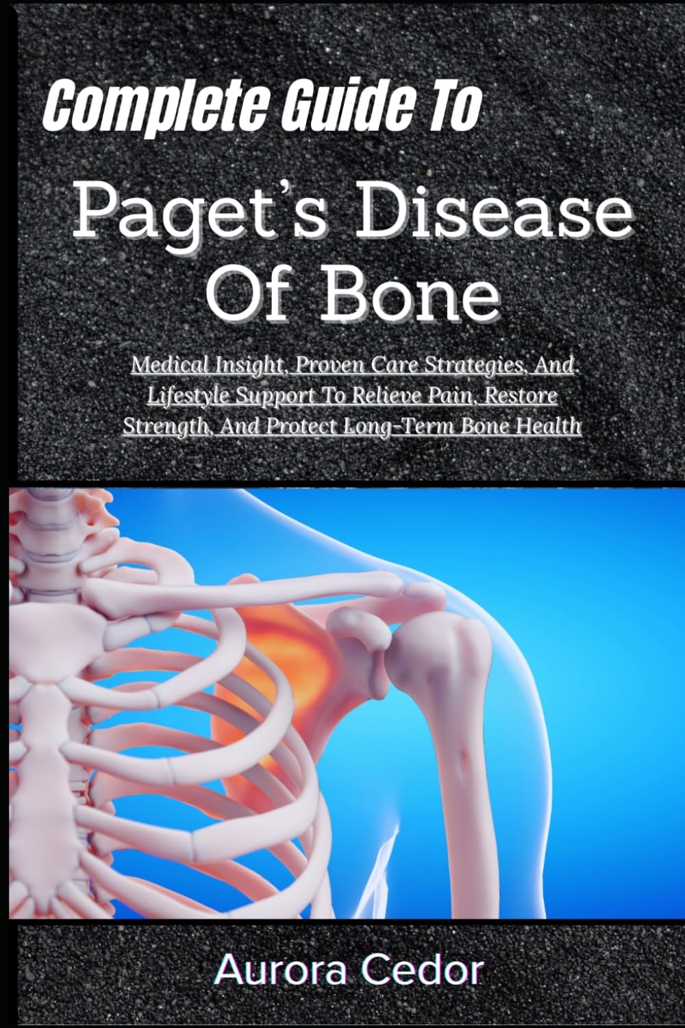 Complete Guide To Paget’s Disease Of Bone: Medical Insight, Proven Care Strategies, And Lifestyle Support To Relieve Pain, Restore Strength, And Protect Long-Term Bone Health