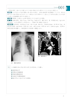 THE総合内科ドリル Ver.2 2 WEB版付: 呼吸器・血液・神経・アレルギー・膠原病および類縁疾患・感染症・救急