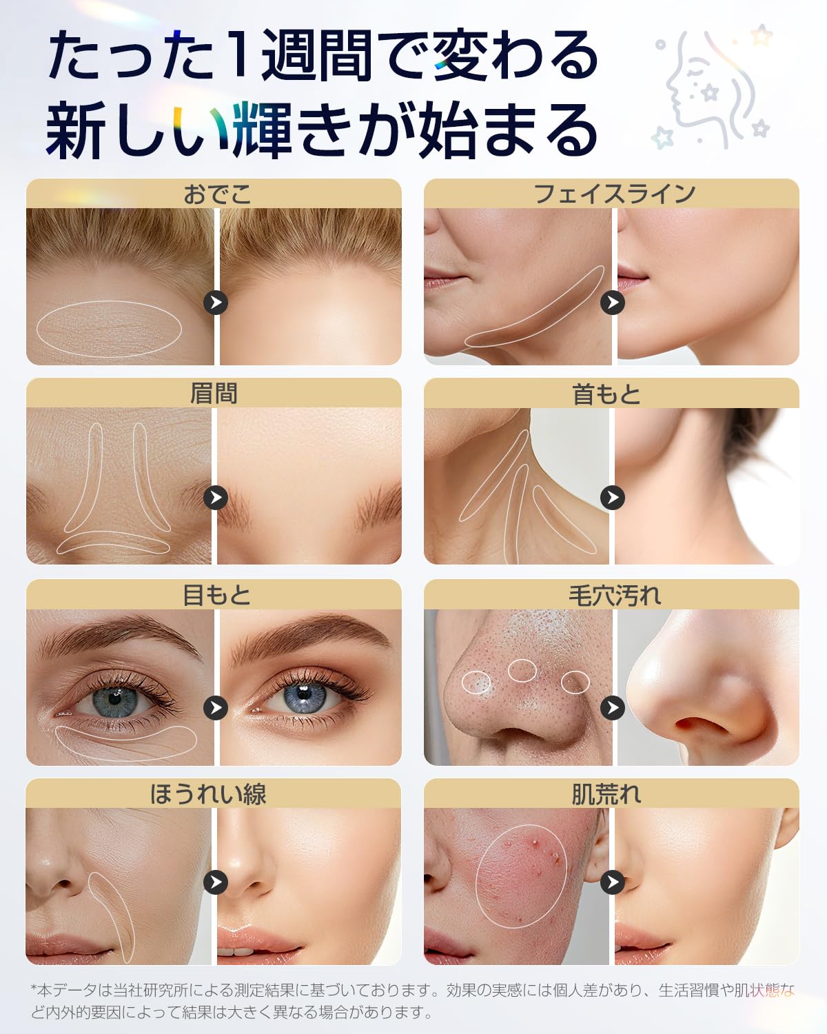 Amazon.co.jp: 美顔器 高周波 RF EMS MC 1台18役 温冷 【2026業界初