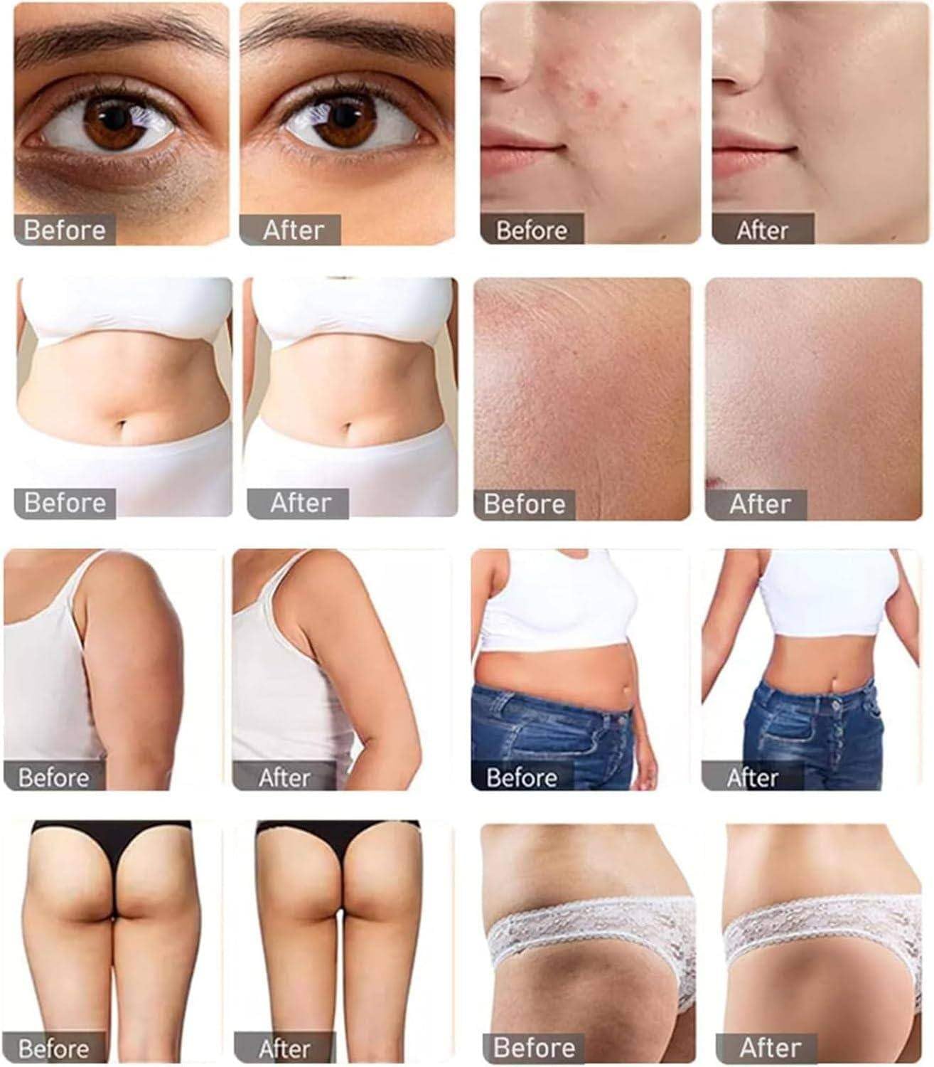 Máquina De Adelgazamiento por Cavitación 7 En 1 40K, Máquina Masajeadora De Rejuvenecimiento De La Piel con Radiofrecuencia Facial Y Corporal, para Tensar La Piel Y Reducir La Grasa