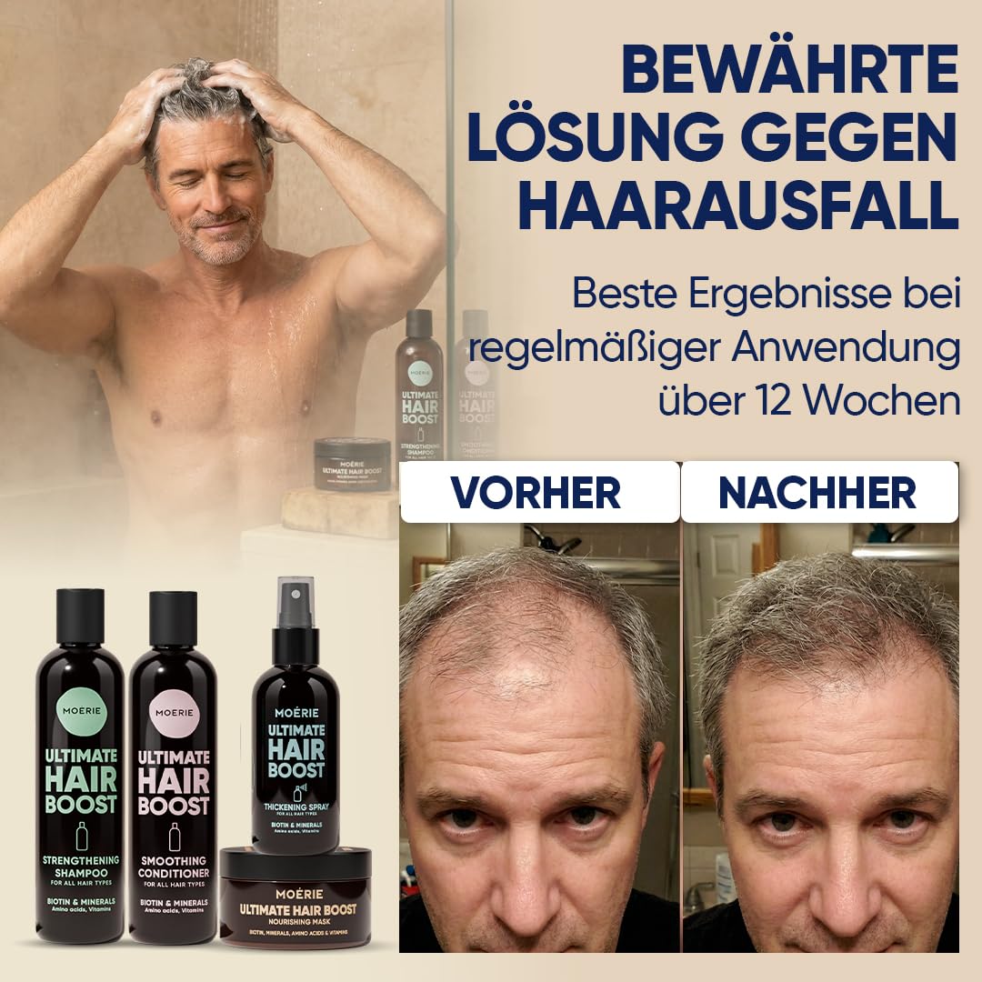 MOERIE Shampoo Set - gegen Haarausfall, Conditioner, Haarwachstum Serum & Haarmaske - natürlich Haarwachstum beschleunigen - Veganes Haarwuchsmittel Frauen & Männer - 77 Mineralien (4er-Set)