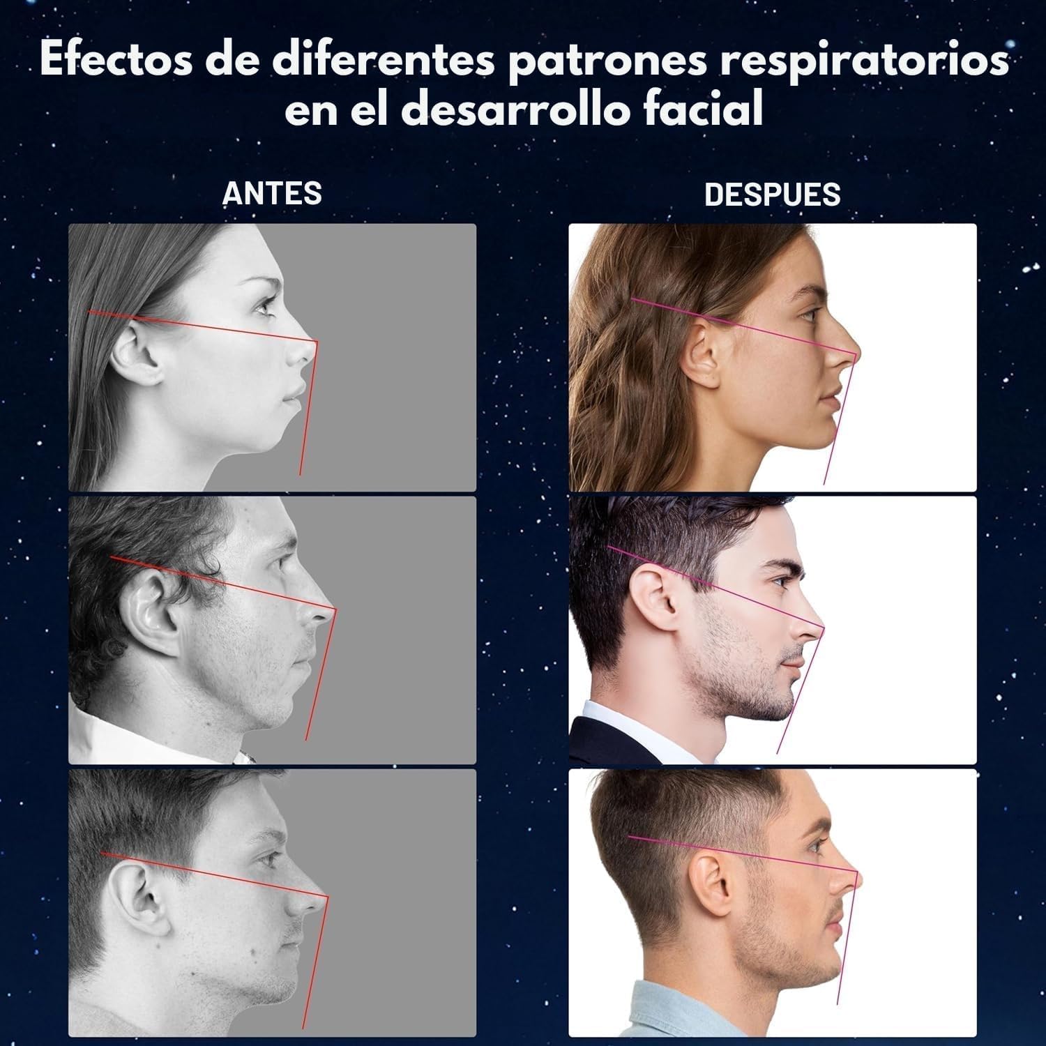 HN® PACK AHORRO 150 Tiras Bucales Para Dormir Antironquidos |Máximo Rendimiento +5 Meses Duración| Adhesivo Hipoalergénico| Mouth Tape For Sleeping| Cintas Bucales Tapabocas |Parches Para Boca Cerrada