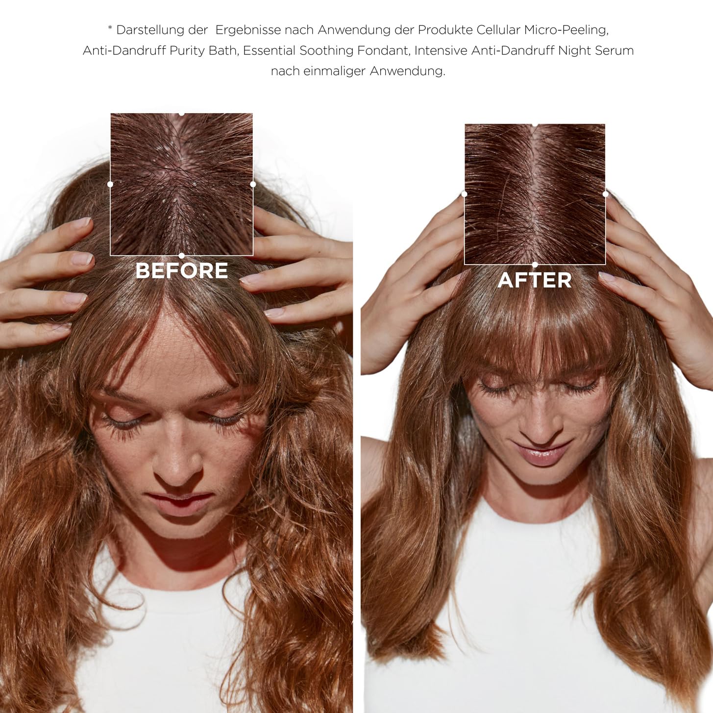 Kérastase, Symbiose, Anti-Schuppen Pflegeroutine mit Peeling, Shampoo, Haarspülung und Haarserum, Für empfindliche, trockene und schuppige Kopfhaut
