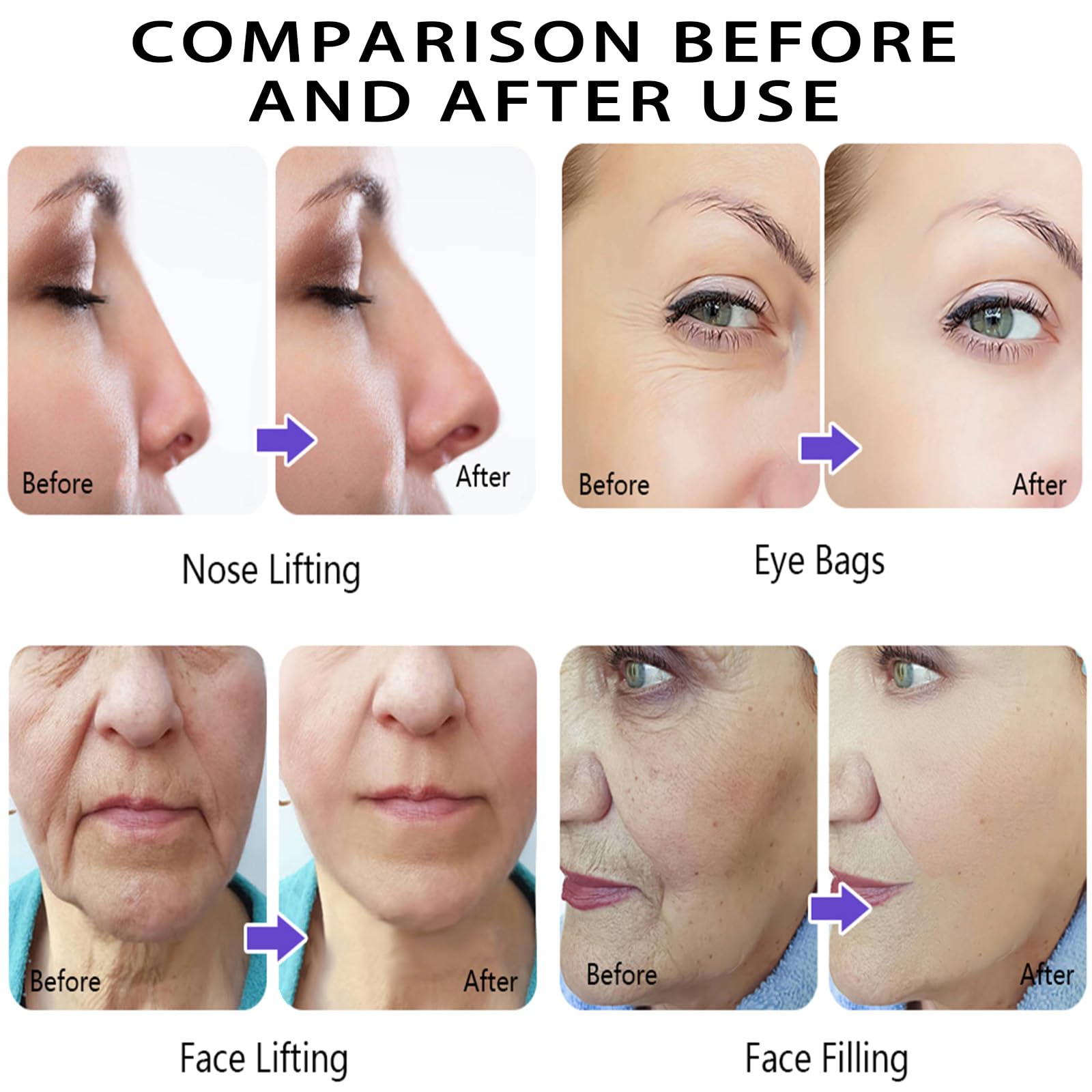 PDO Threads Mono Type Face Lift Whole Body Tightening 100pcs,26G-60MM 29G-38MM 29G-25MM Drei Größenoptionen (29G*38MM)