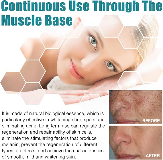 Dark Spot Remover for Face and Body,Dark Spot Corrector Freckle Remover,Pigmentation Removal Cream,Melasma Removal Cream for Face,Containing Niacinamide and Glycerol,Brightening,20ML
