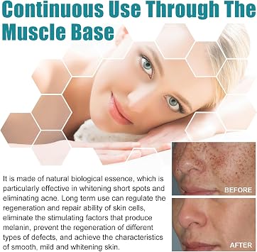 Dark Spot Remover for Face and Body,Dark Spot Corrector Freckle Remover,Pigmentation Removal Cream,Melasma Removal Cream for Face,Containing Niacinamide and Glycerol,Brightening,20ML