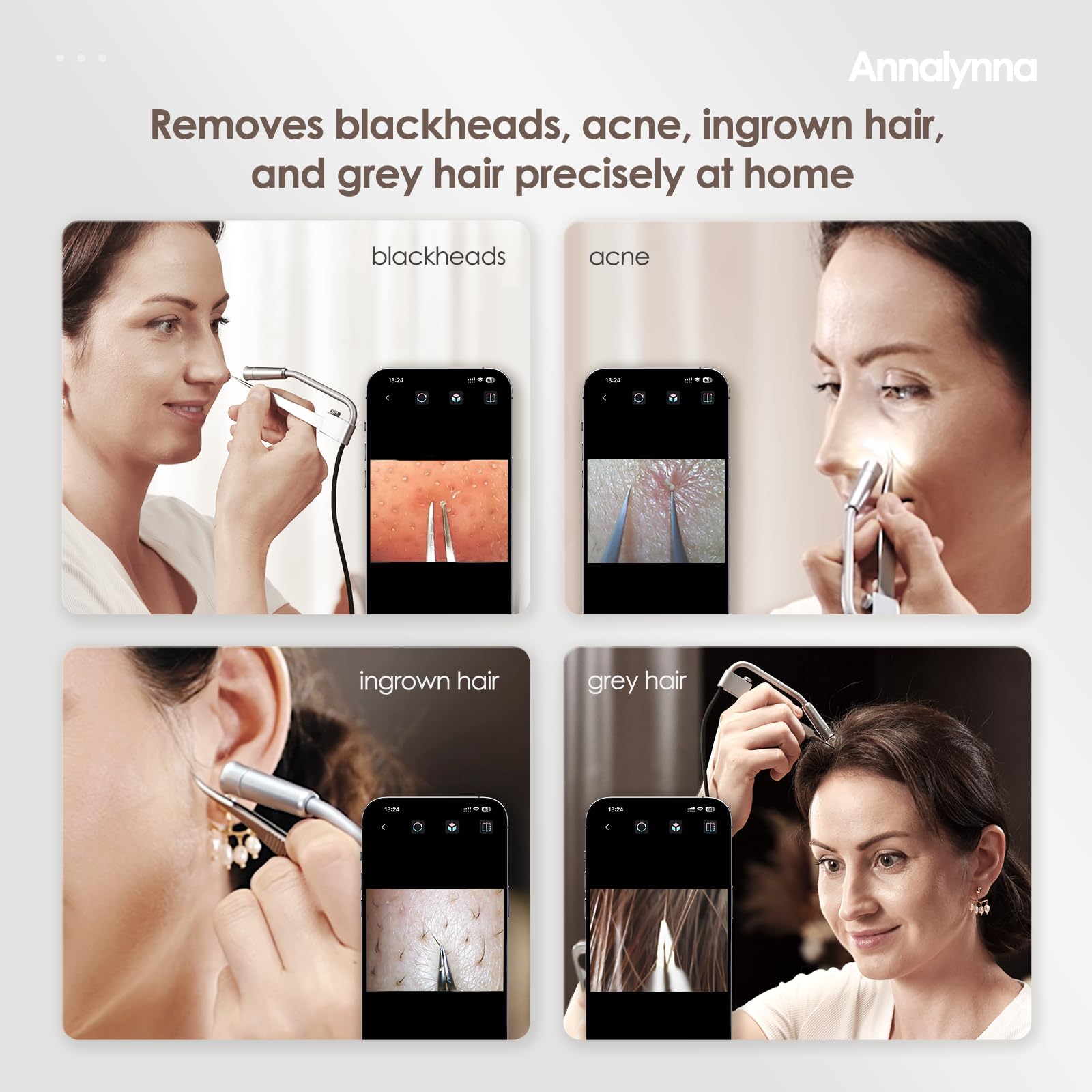 Luma 1 Visual Blackhead Remover Tweezers with Camera, Pimple Popper Tool with Camera 20x Magnification, 1080P, 8 LED Lights - Image 3
