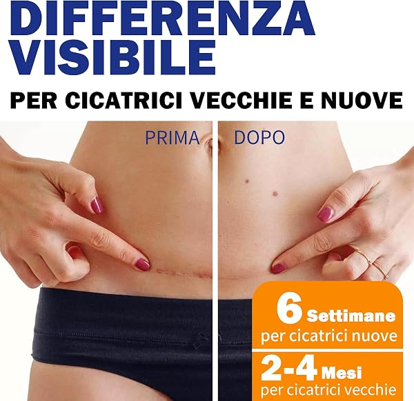 Cerotti Silicone Cicatrici Fogli di Silicone per Cicatrici, Rimuove e Schiarisce Cicatrici, Adatto a Pelli Sensibili, Tagliabile e Riutilizzabile (4cm*1.8m) - 5
