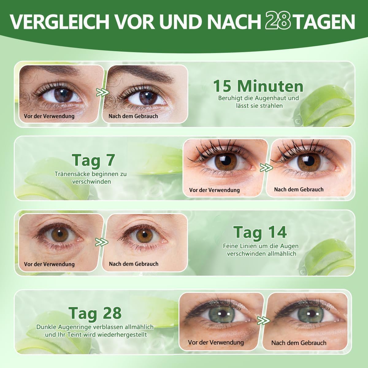 Augenpads,60 PCS Eye Pads,Augenpads Gegen Augenringe,Deep Hydration Feuchtigkeitsspendende Eye Pad Mask,Kollagen Hydrogel Anti Aging,Hyaluronsäure Augenmaske Dunkle Augenringe Entfernen (Grün25101301)