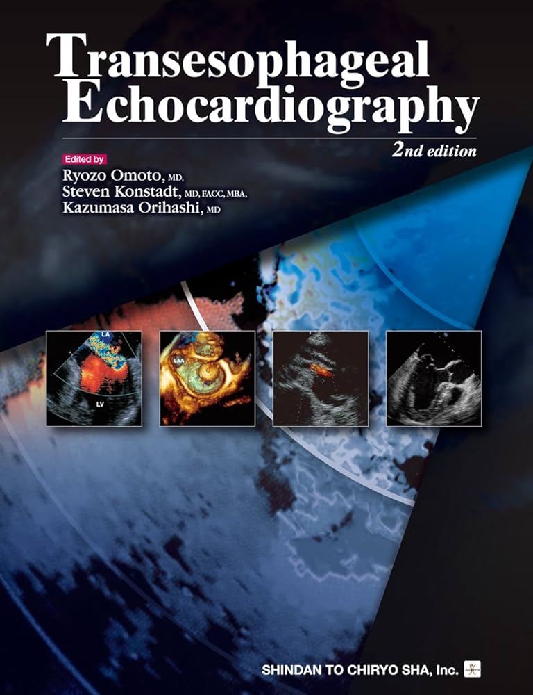 Transesophageal Echocardiography [大型本] 尾本 良三 Amazon.co.jp: Transesophageal Echocardiography : 尾本 良三