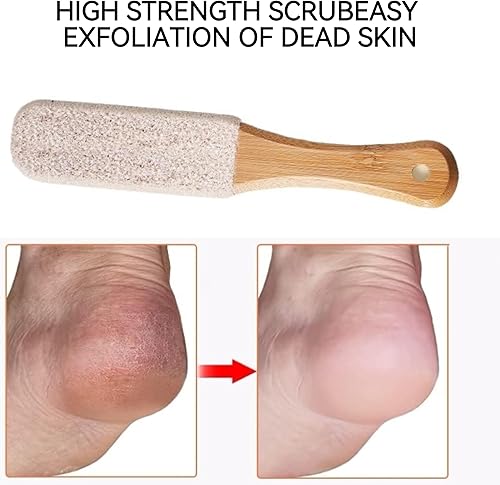 Miniatura 2 de Paquete de 2 limas profesionales de pedicura y piedra pómez, removedor de callos y limpiador de pies para piel muerta, pies ásperos secos y talones