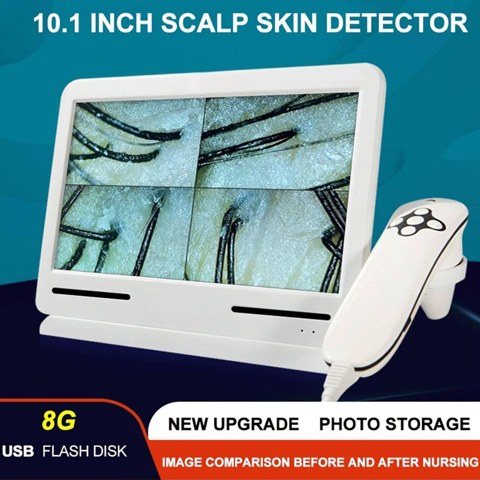 Skin Diagnosis Hair Analyzer, 10 Pulgadas Recargable Cuero Cabelludo Folículo Piloso Aceite De Aumento De Humedad Detector Analizador De La Piel Del Pigmento Tester Machine