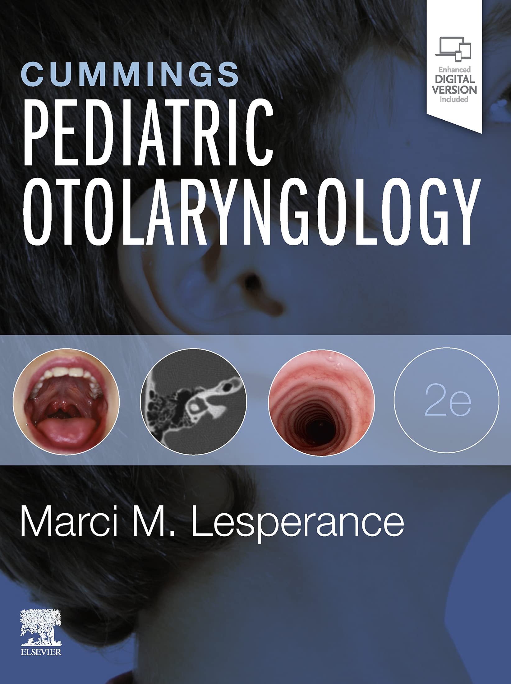 Cummings Pediatric Otolaryngology E-Book