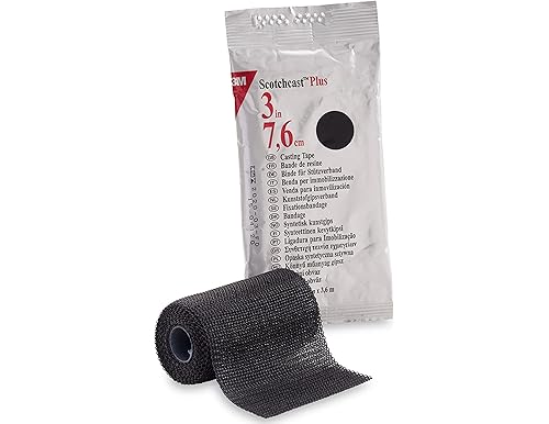 Cast Kits for Broken Bones: Ultimate Guide to Effective Healing