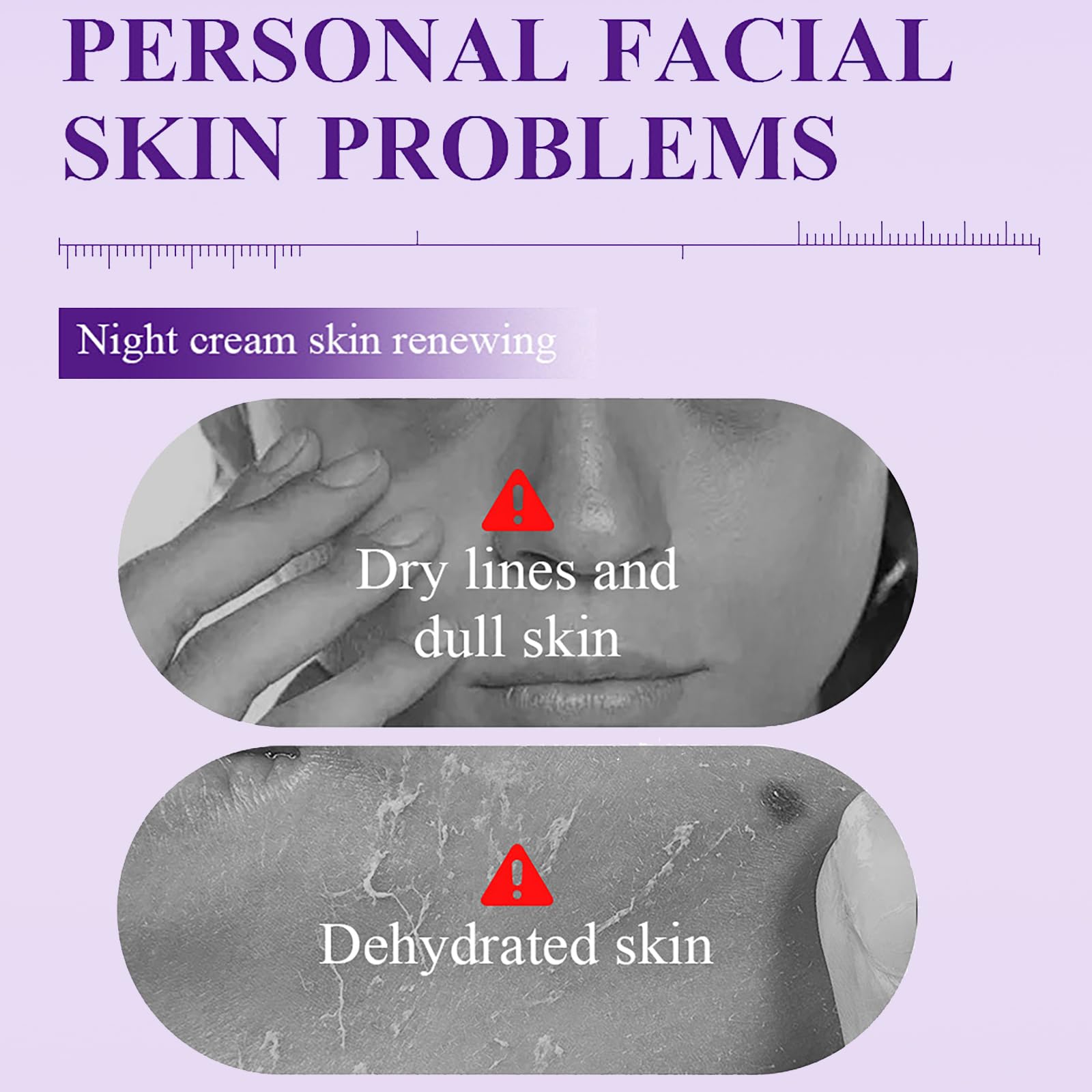 Amazon.com: Skin Renewing Night Cream - Niacinamide, Peptide