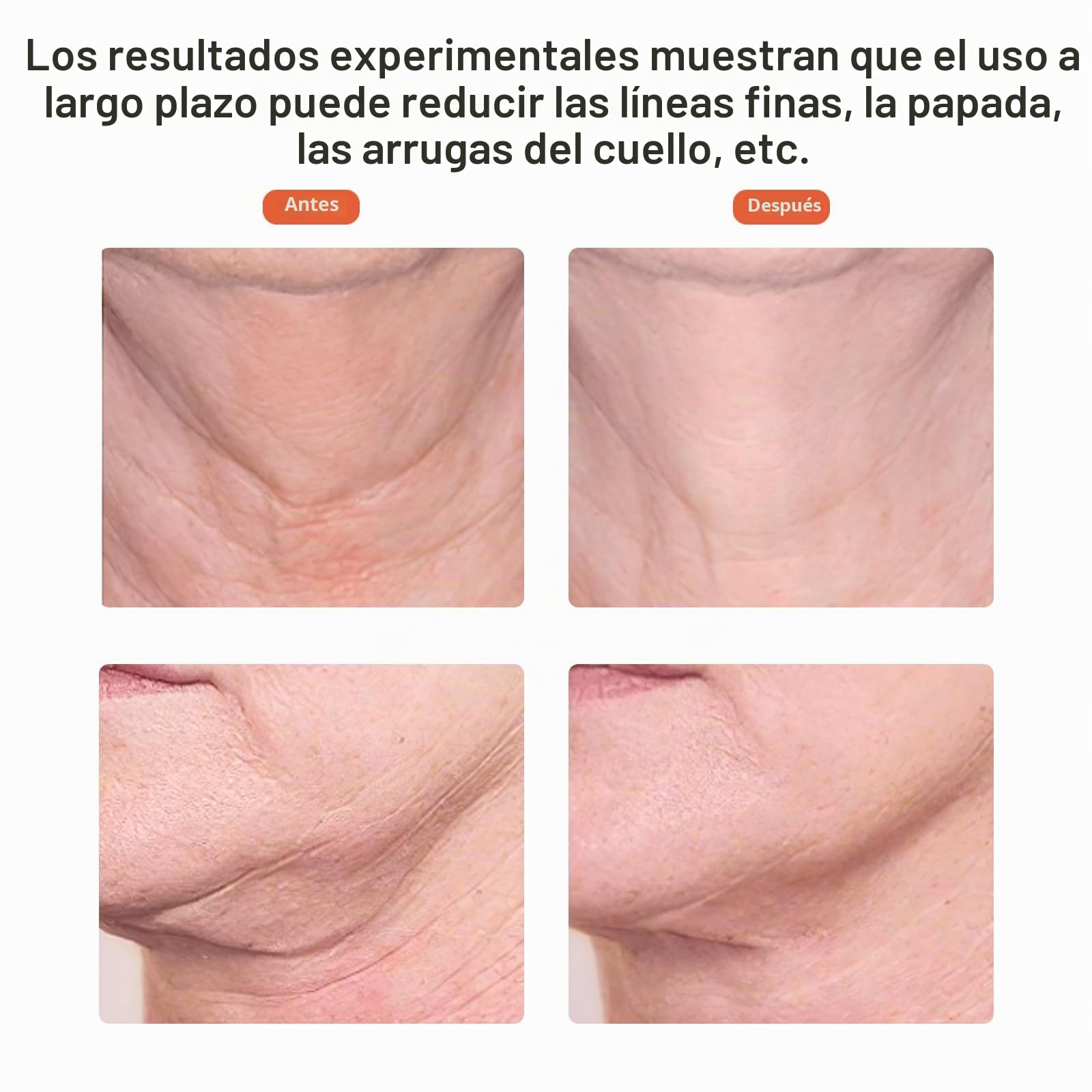 Ms.W Dispositivo de Belleza Electrico Masajeador Cara, Masaje Facial Aparatos Para Flacidez Cara Masajeador Facial Antiarrugas, Maquina Quita Arrugas Lifting Facial Skin Care Masajeadores Faciales